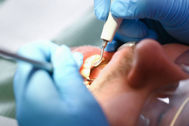 Best Dentist for Tooth Abscess  in Beaver Dam, KY