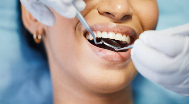 Best Knocked-Out Tooth Emergency  in Beaver Dam, KY